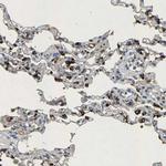 LPCAT1 Antibody in Immunohistochemistry (Paraffin) (IHC (P))