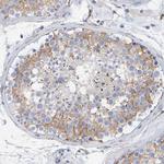 MAP1B Antibody in Immunohistochemistry (Paraffin) (IHC (P))