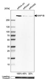 MAP1B Antibody