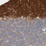 ARTS Antibody in Immunohistochemistry (Paraffin) (IHC (P))