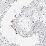 ARTS Antibody in Immunohistochemistry (Paraffin) (IHC (P))