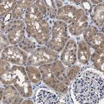 ATP Citrate Lyase Antibody in Immunohistochemistry (Paraffin) (IHC (P))