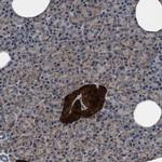 ATP Citrate Lyase Antibody in Immunohistochemistry (Paraffin) (IHC (P))