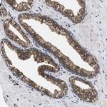 ATP Citrate Lyase Antibody in Immunohistochemistry (Paraffin) (IHC (P))