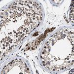 ATP Citrate Lyase Antibody in Immunohistochemistry (Paraffin) (IHC (P))