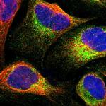 CALCOCO2 Antibody in Immunocytochemistry (ICC/IF)