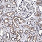 CALCOCO2 Antibody in Immunohistochemistry (Paraffin) (IHC (P))