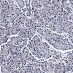 CALCOCO2 Antibody in Immunohistochemistry (Paraffin) (IHC (P))