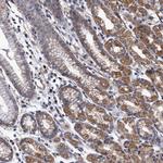 CALCOCO2 Antibody in Immunohistochemistry (Paraffin) (IHC (P))