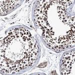 CALCOCO2 Antibody in Immunohistochemistry (Paraffin) (IHC (P))