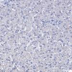 BICD2 Antibody in Immunohistochemistry (Paraffin) (IHC (P))