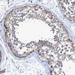 BICD2 Antibody in Immunohistochemistry (Paraffin) (IHC (P))