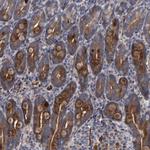 SLIT2 Antibody in Immunohistochemistry (Paraffin) (IHC (P))