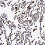 SLIT2 Antibody in Immunohistochemistry (Paraffin) (IHC (P))