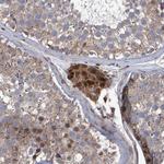 SLIT2 Antibody in Immunohistochemistry (Paraffin) (IHC (P))