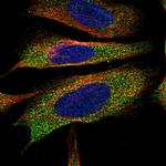 EPHX2 Antibody in Immunocytochemistry (ICC/IF)