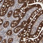 EPHX2 Antibody in Immunohistochemistry (Paraffin) (IHC (P))