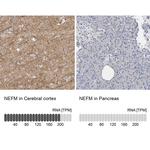 NEFM Antibody