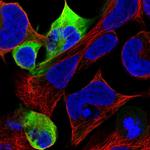 NEFM Antibody in Immunocytochemistry (ICC/IF)