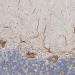 NEFM Antibody in Immunohistochemistry (Paraffin) (IHC (P))