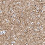 NEFM Antibody in Immunohistochemistry (Paraffin) (IHC (P))