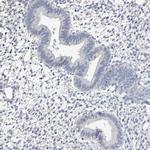 NEFM Antibody in Immunohistochemistry (Paraffin) (IHC (P))