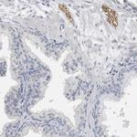 NEFM Antibody in Immunohistochemistry (Paraffin) (IHC (P))