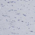 IDO Antibody in Immunohistochemistry (Paraffin) (IHC (P))