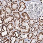 DECR1 Antibody in Immunohistochemistry (Paraffin) (IHC (P))