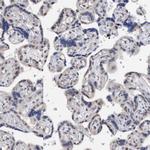 DECR1 Antibody in Immunohistochemistry (Paraffin) (IHC (P))