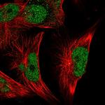 MSK2 Antibody in Immunocytochemistry (ICC/IF)