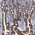 DECR1 Antibody in Immunohistochemistry (Paraffin) (IHC (P))