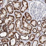 DECR1 Antibody in Immunohistochemistry (Paraffin) (IHC (P))