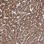 DECR1 Antibody in Immunohistochemistry (Paraffin) (IHC (P))