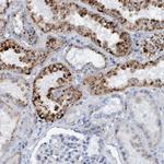 SGSH Antibody in Immunohistochemistry (Paraffin) (IHC (P))