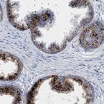 SGSH Antibody in Immunohistochemistry (Paraffin) (IHC (P))