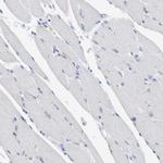 SGSH Antibody in Immunohistochemistry (Paraffin) (IHC (P))