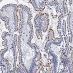 SGSH Antibody in Immunohistochemistry (Paraffin) (IHC (P))