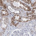 SGSH Antibody in Immunohistochemistry (Paraffin) (IHC (P))