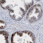 SGSH Antibody in Immunohistochemistry (Paraffin) (IHC (P))