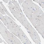 SGSH Antibody in Immunohistochemistry (Paraffin) (IHC (P))