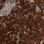 4EBP1 Antibody in Immunohistochemistry (Paraffin) (IHC (P))