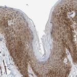 4EBP1 Antibody in Immunohistochemistry (Paraffin) (IHC (P))