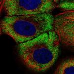 ZNF23 Antibody in Immunocytochemistry (ICC/IF)