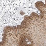 ZNF23 Antibody in Immunohistochemistry (Paraffin) (IHC (P))