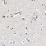 NFkB p100 Antibody in Immunohistochemistry (Paraffin) (IHC (P))