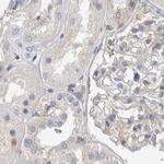 NFkB p100 Antibody in Immunohistochemistry (Paraffin) (IHC (P))