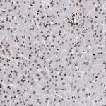 hnRNP M Antibody in Immunohistochemistry (Paraffin) (IHC (P))