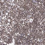 hnRNP M Antibody in Immunohistochemistry (Paraffin) (IHC (P))