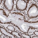 hnRNP M Antibody in Immunohistochemistry (Paraffin) (IHC (P))